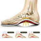 FootReset™  Orthopedic Arch Support Insoles