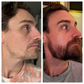 BeardFill™ Beard growth serum