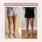 LightLegs™ Compression Leggings for Lipoedema & Swelling Relief