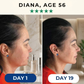 GoldLift™ - 24K Collagen Chin Lifting Mask
