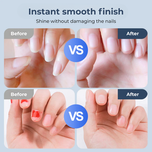 EasyClip™ – Electric Nail Clipper