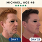 GoldLift™ - 24K Collagen Chin Lifting Mask