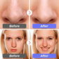 GlowClear™ Professional facial cleansing device