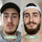 BeardFill™ Beard growth serum