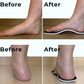 FootReset™  Orthopedic Arch Support Insoles