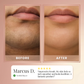 5-Minute Smooth Kit