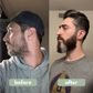 BeardFill™ Beard growth serum