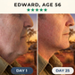 GoldLift™ - 24K Collagen Chin Lifting Mask